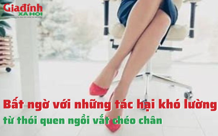 Bất ngờ với những tác hại khó lường từ thói quen ngồi vắt chéo chân