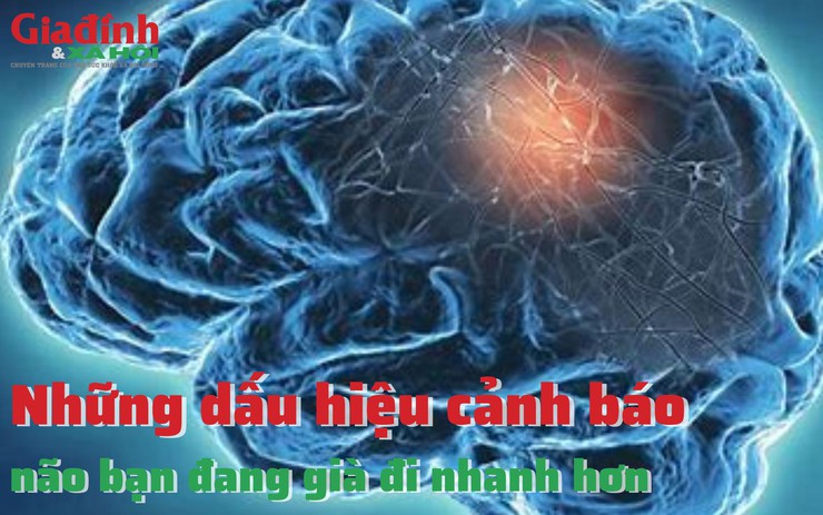 Những dấu hiệu cảnh báo não bạn đang già đi nhanh hơn