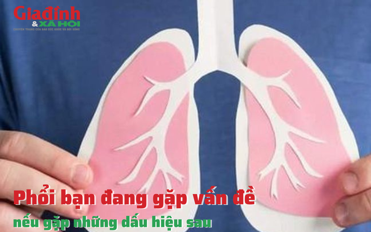 Phổi bạn đang gặp vấn đề nếu có những dấu hiệu sau