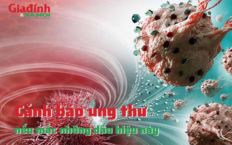 Cảnh báo ung thư nếu mắc những dấu hiệu này