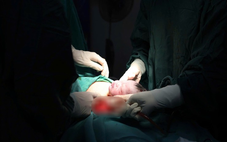 Thâm nhập hậu trường một ca mổ lấy thai ở Ninh Bình: Hành trình đưa 'thiên thần' ra đời