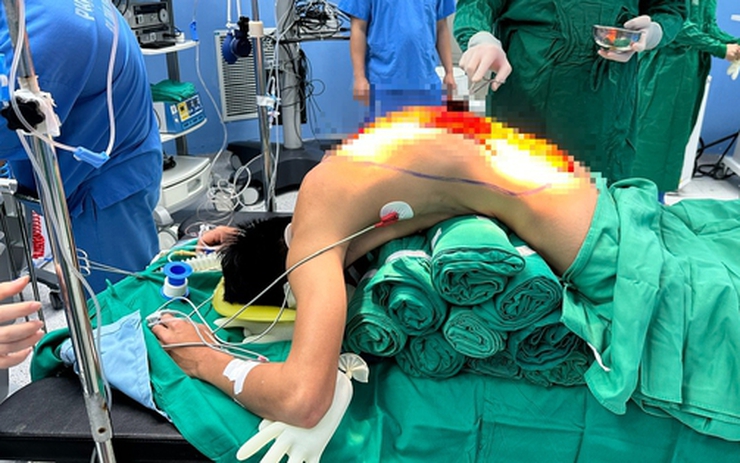 10 giờ phẫu thuật giải cứu người đàn ông 'cong như con tôm' , 7 năm cúi mặt xuống đất