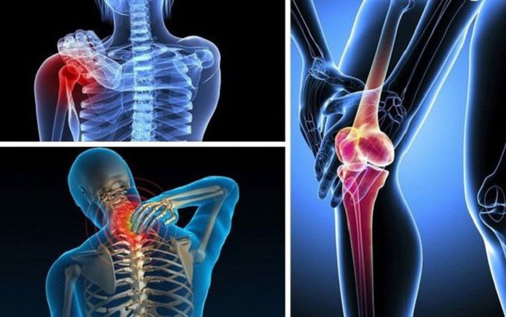Bác sĩ cảnh báo 6 dấu hiệu ung thư xương giai đoạn đầu mà nhiều người vẫn nghĩ là thiếu canxi
