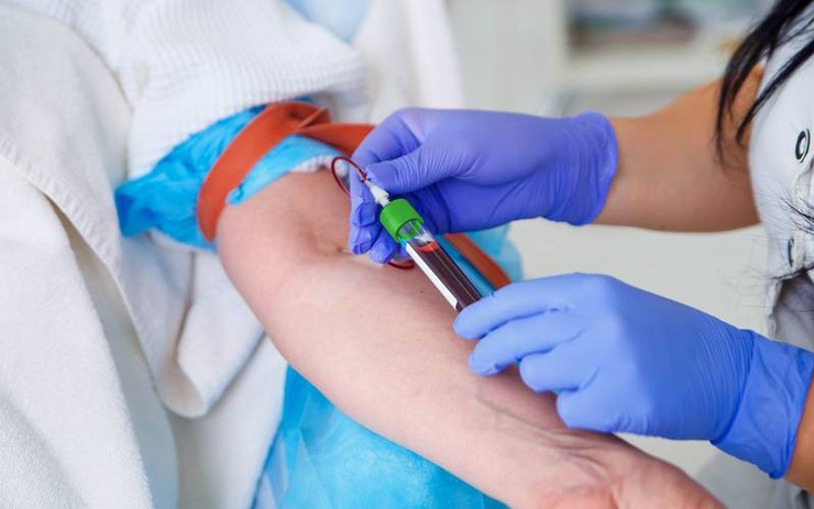 PGS Nguyễn Lân Hiếu cảnh báo: Một sai số nhỏ khi xét nghiệm máu tại nhà cũng có thể khiến người bệnh tưởng suy thận, ung thư