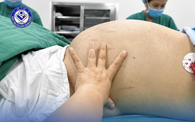 Thiếu nữ 19 tuổi mang khối u buồng trứng khoảng 30cm vì tâm lý chủ quan phụ nữ Việt hay mắc phải
