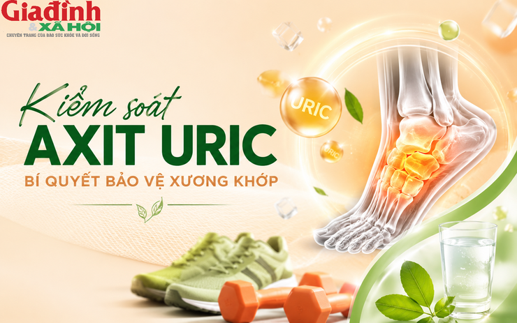 Chỉ số Axit uric tăng cao: Chuyên gia khuyên nên làm ngay những điều này để tránh gout