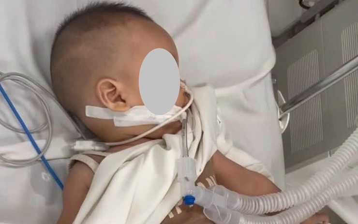 Em bé nguy kịch sau tai nạn với thanh chắn giường