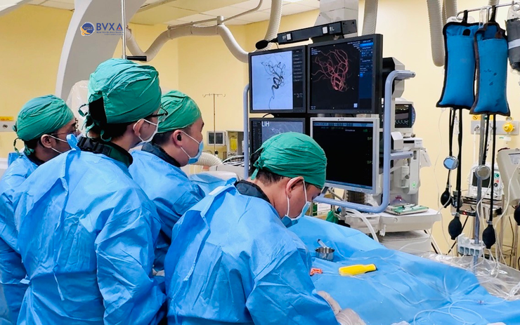Người phụ nữ 50 tuổi đau đầu dữ dội trong lúc ngủ, đi khám phát hiện vỡ túi phình động mạch não