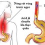 Người phụ nữ 30 tuổi bị loét hoàn toàn thực quản vì một sai lầm nhiều người Việt mắc phải khi uống thuốc