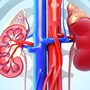 Suy thận: Nhận diện sớm các dấu hiệu cảnh báo và hướng phòng ngừa