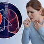 Người bệnh ung thư phổi: Tôi hoàn toàn không nghĩ mình mắc... vì không có triệu chứng gì!