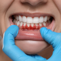 Nướu răng khỏe mạnh không khó: 1 thay đổi nhỏ trong bữa ăn, hiệu quả bất ngờ