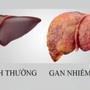 Loại quả mùa hè rẻ tiền, ngọt mát giúp làm mát gan, người Việt dùng vào thời điểm này để giúp gan thải độc