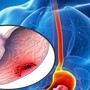 Phát hiện ung thư từ dấu hiệu chóng mặt