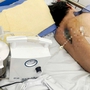 Người đàn ông 57 tuổi ở Hưng Yên sốt kéo dài, liệt hai chân từ nguyên nhân không ngờ