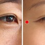 5 động tác đơn giản hằng ngày xóa mờ nếp nhăn đuôi mắt