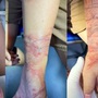 Tiếp xúc với sứa trong khi tắm biển, cánh tay bé gái tổn thương nặng nề