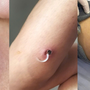 Cảnh báo căn bệnh hiếm gặp xuất hiện ở Việt Nam