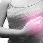 4 dấu hiệu cảnh báo ung thư vú phụ nữ không nên bỏ qua