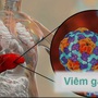 Lưu ý 6 nhóm thực phẩm gây hại gan, không nên ăn để phòng bệnh viêm gan A
