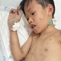 MS 1012: Con lớn bị tâm thần, người cha nghèo cầu cứu cộng đồng để điều trị cho con trai út mắc bệnh hiếm gặp