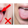 Những dấu hiệu ở lưỡi cảnh báo vấn đề sức khỏe đáng lo ngại mà nhiều người bỏ qua