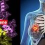 7 yếu tố nguy cơ gây bệnh ung thư vú