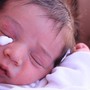 Phát hiện bệnh cực kỳ hiếm gặp ở bé sơ sinh sau chào đời 10 giờ tuổi