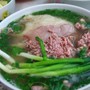 Người phụ nữ 43 tuổi bất ngờ suy gan, suy thận vì 1 sai lầm trong lúc ăn phở mà nhiều người Việt mắc phải