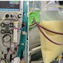 Người phụ nữ ở Phú Thọ đang khỏe mạnh thì viêm tụy cấp, mỡ máu cao 37 lần, thừa nhận 1 sai lầm nhiều người Việt mắc phải