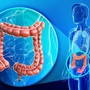 Dấu hiệu nhận biết ung thư trực tràng: Người trong gia đình có dấu hiệu này cần cảnh giác