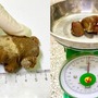 Người đàn ông 46 tuổi ở Quảng Ninh có sỏi thận 'khủng' như san hô do mắc sai lầm này trong nhiều năm