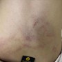 Điều tra vụ bé gái 4 tuổi nghi bị cô giáo bạo hành ở Hà Nội