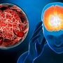 6 nhóm người nguy cơ đột quỵ cao, ai có dấu hiệu này cần cảnh giác!