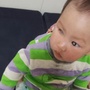 Sức khỏe của bé gái 2 tuổi bị ung thư võng mạc đã có những tiến triển mới