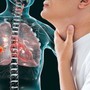 Người đàn ông 60 tuổi bất ngờ phát hiện ung thư phổi từ dấu hiệu nhiều người Việt mắc phải, nhưng đều bỏ qua