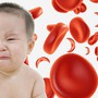 5 triệu chứng cảnh báo thiếu sắt ở trẻ em cha mẹ dễ bỏ qua và cách bổ sung an toàn
