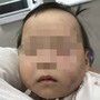 Bé gái 1 tuổi bị bầm tím mặt khi gửi nhà trẻ ở Bắc Ninh: Công an tạm giữ cô giáo