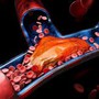 4 dấu hiệu cảnh báo cơ thể có mạch máu bị tắc nghẽn: Kiểm tra ngay bạn có không, nếu không có xin chúc mừng