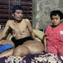MS 1058: Người đàn ông có khối u khổng lồ đau xót nhìn vợ con lay lắt vì bệnh tật