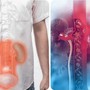 Thanh niên 20 tuổi suy thận giai đoạn cuối thừa nhận một sai lầm nhiều người Việt mắc phải