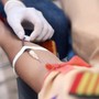 Người phụ nữ ung thư dạ dày giai đoạn cuối thừa nhận đã chủ quan bỏ qua dấu hiệu này