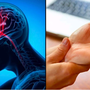 Dấu hiệu nguy hiểm nhất của đột quỵ không phải tê tay chân, nhiều người vẫn đang hiểu lầm