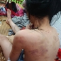 Vụ nữ sinh lớp 4 nghi bị bạn đánh hội đồng: Cao Bằng yêu cầu khẩn trương kiểm tra, xử lý