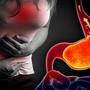 5 loại trái cây ít chua được chuyên gia khuyên dùng cho người trào ngược dạ dày: Vừa dễ tiêu hóa, vừa hỗ trợ giảm khó chịu