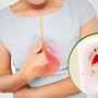 Người phụ nữ 63 tuổi phát hiện ung thư dạ dày từ dấu hiệu nhiều người Việt thường bỏ qua
