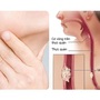 Người đàn ông phát hiện mắc ung thư thực quản thừa nhận 2 sai lầm nhiều người Việt mắc phải