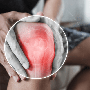Không phải leo cầu thang, đây mới là 3 thói quen âm thầm 'bào mòn' đầu gối sau tuổi 50