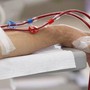 Người phụ nữ huyết áp tăng cao, đi khám phát hiện suy thận giai đoạn 4 vì 1 sai lầm nhiều người Việt mắc phải