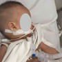 Em bé nguy kịch sau tai nạn với thanh chắn giường